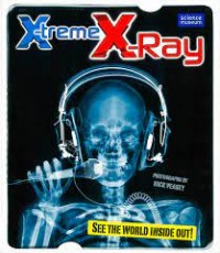 X-Treme X-Ray